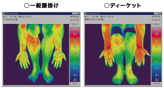 サーモグラフィーによる皮膚表面温度比較