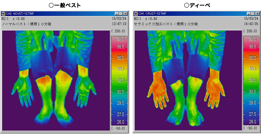 サーモグラフィーによる皮膚表面温度比較