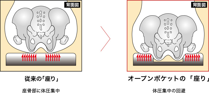 お尻の痛みの原因は、座骨部への体圧集中。