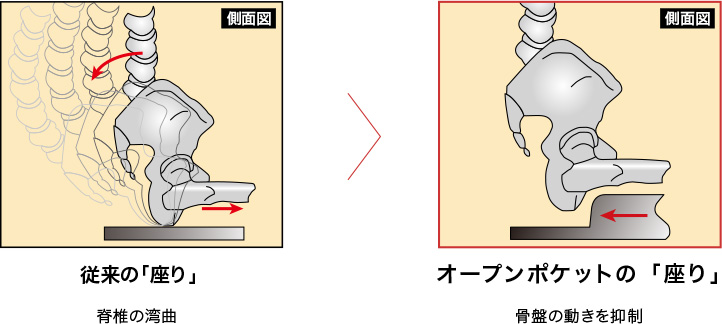腰の痛み疲れの原因は、脊椎の湾曲。