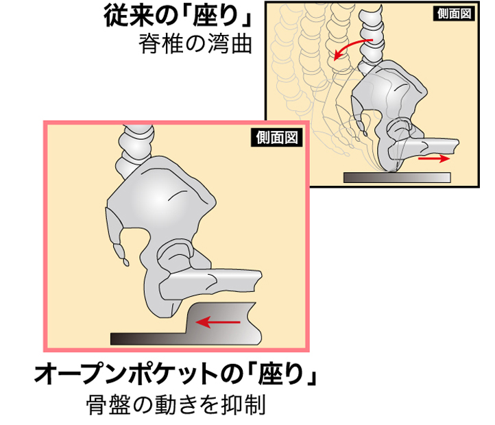 腰の痛み疲れの原因は、脊椎の湾曲。